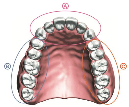 Mouth section map showing A, B, and C implant zones
